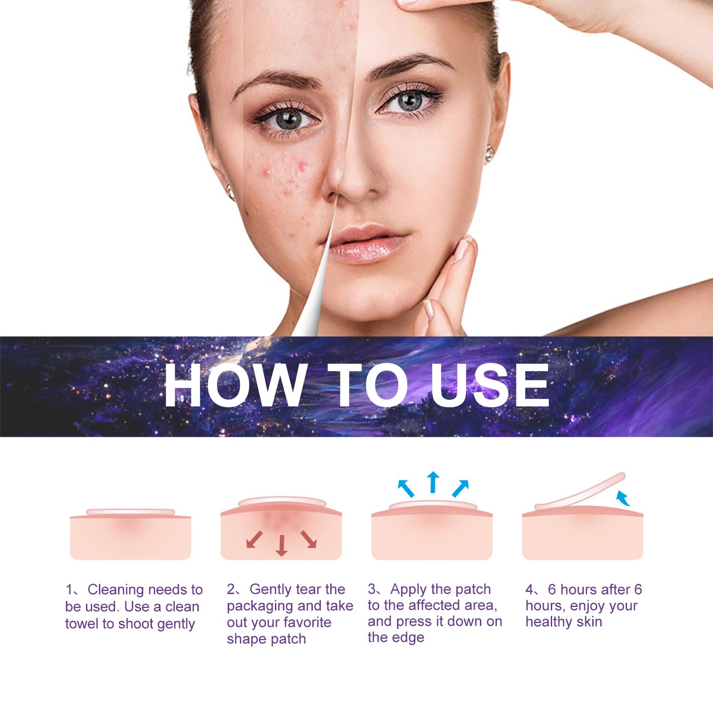 Trendy Acne Patch, Fade Acne, Clear Acne, Waterproof Breathable Repair Acne Muscle Pattern pimple sticker, acne patch, trendy acne patches, clear skin acne patch, waterproof acne patch, breathable acne patch, repair acne patch, salicylic acid acne patch