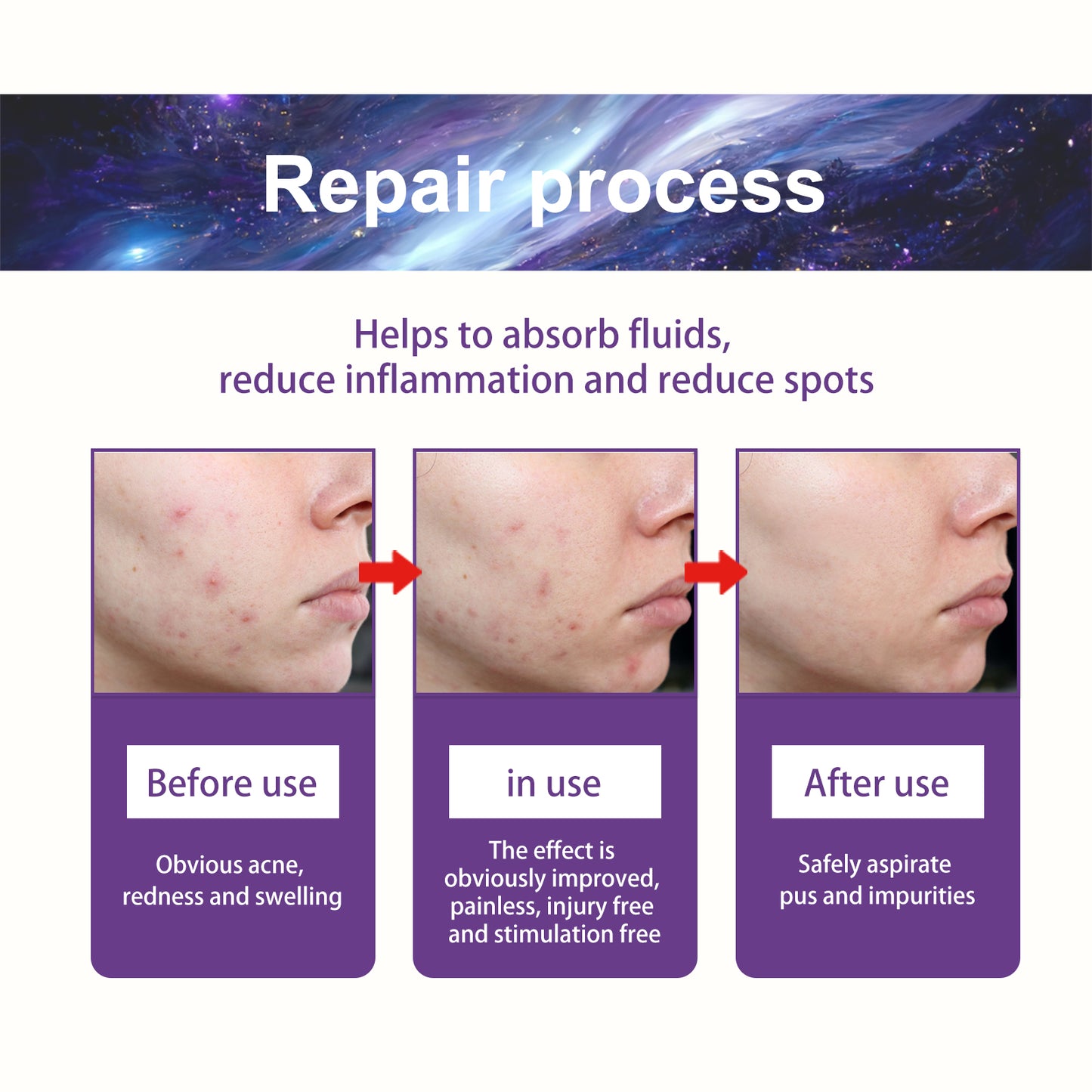 Trendy Acne Patch, Fade Acne, Clear Acne, Waterproof Breathable Repair Acne Muscle Pattern pimple sticker, acne patch, trendy acne patches, clear skin acne patch, waterproof acne patch, breathable acne patch, repair acne patch, salicylic acid acne patch