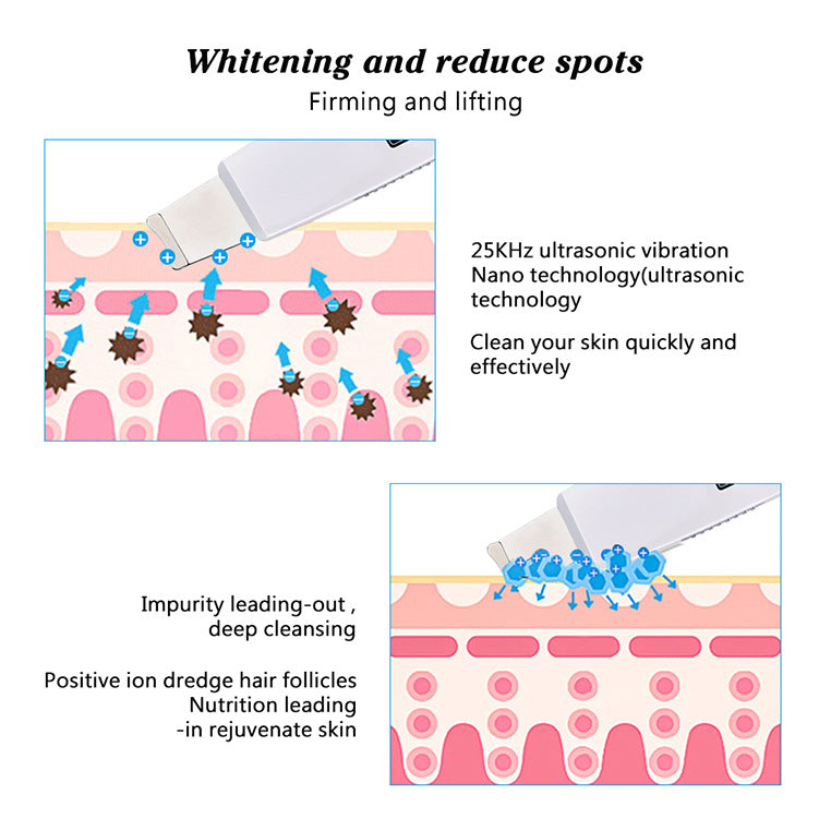 HailiCare Ultrasonic Peeling Machine To Remove Aging Horny Peeling Instrument Hydrogen And Oxygen Small Bubble Beauty